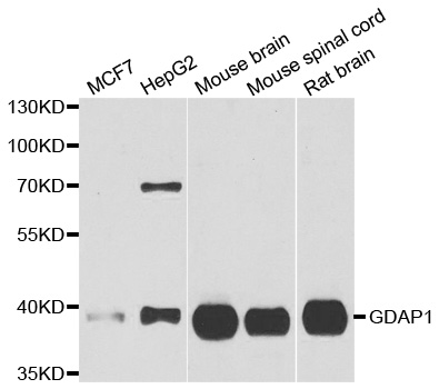 Anti-GDAP1 Antibody