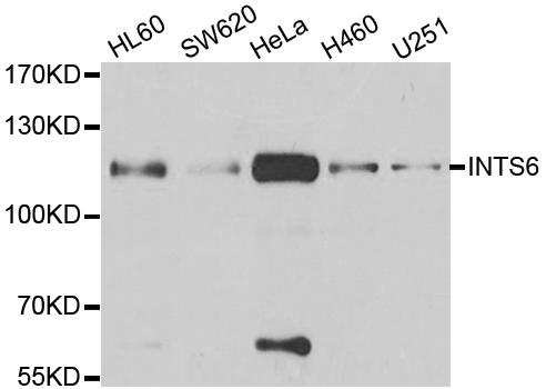 Anti-INTS6 Antibody