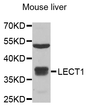Anti-LECT1 Antibody