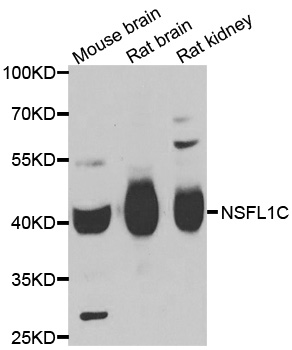 Anti-NSFL1C Antibody