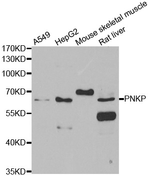 Anti-PNKP Antibody