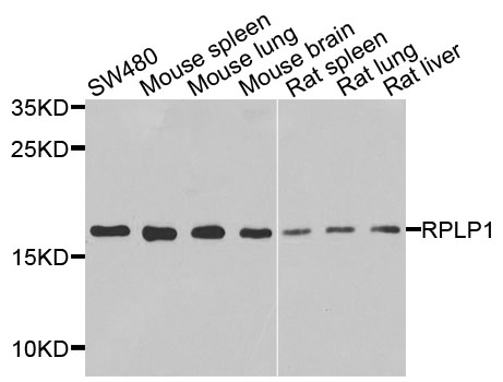 Anti-RPLP1 Antibody