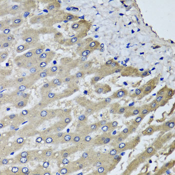 Anti-SCYL1 Antibody