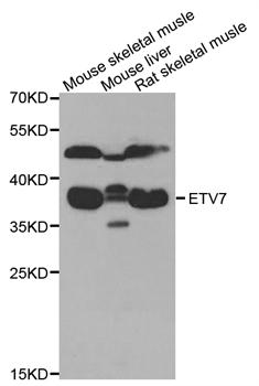 Anti-ETV7 Antibody