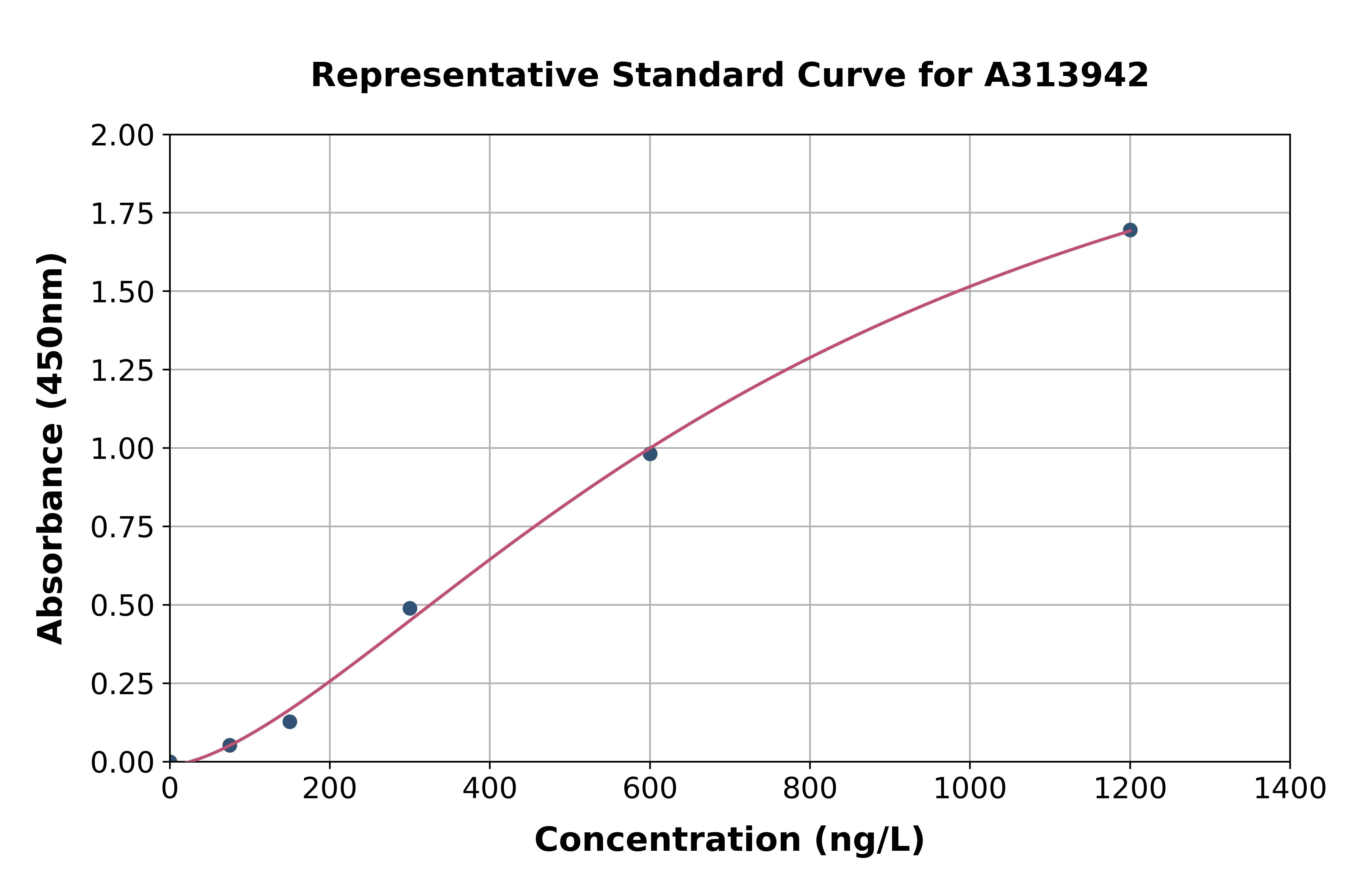 Human CK1 epsilon ELISA Kit