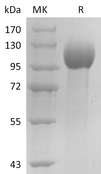 Recombinant Human Estrogen-Induced Gene 121 Protein (6xHis Tag)