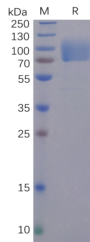Recombinant SARS-CoV-2 Spike Glycoprotein S1 NTD Protein (Fc Tag)