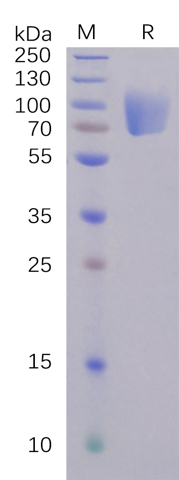 Recombinant SARS-CoV-2 Spike Glycoprotein S1 NTD Protein (Fc Tag)