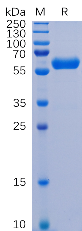 Recombinant SARS-CoV-2 Spike Glycoprotein RBD Protein (Fc Tag)