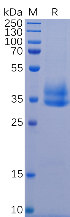 Recombinant Human IL-2 Receptor beta/p75 Protein (6xHis Tag)