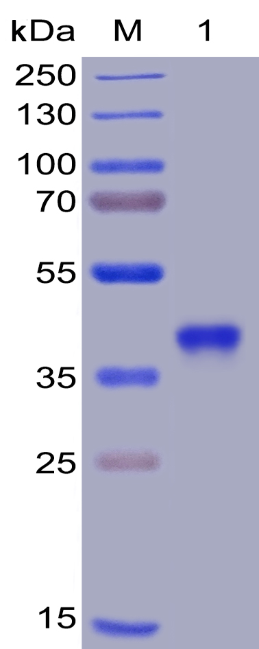 Recombinant SARS-CoV-2 Spike Glycoprotein RBD Protein (6xHis Tag)