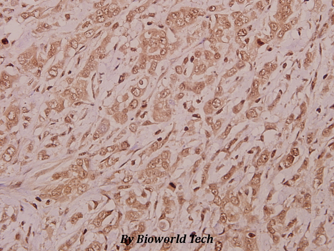 Anti-CSRNP2 (K127) Antibody