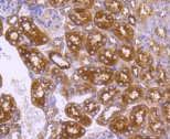 Anti-DNAJC15 Antibody Anti-DNAJC15 Antibody