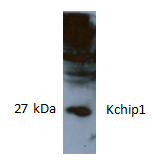 Anti-KCHIP1 Antibody