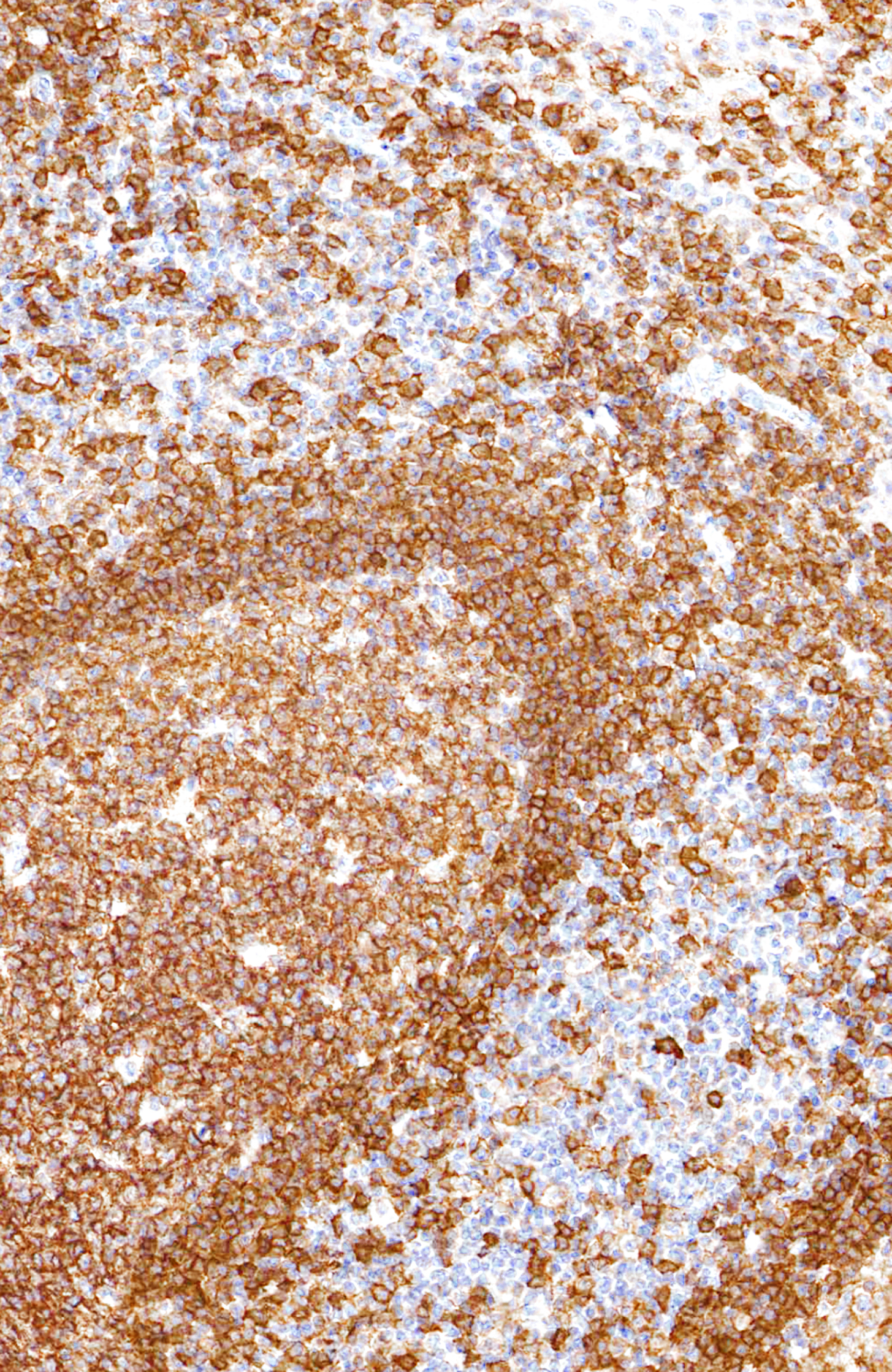 Anti-CD19 Antibody [IHC529]