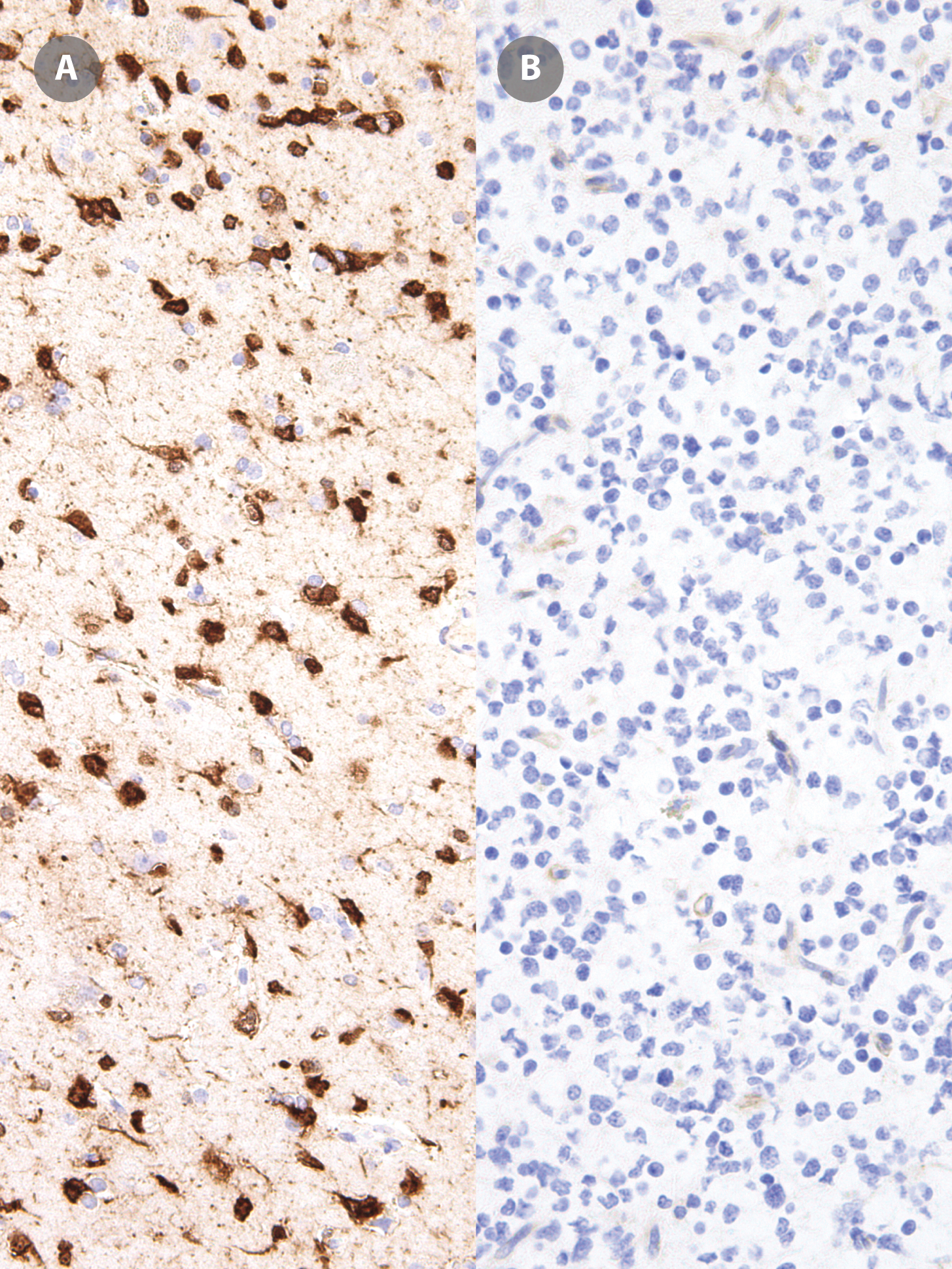 Anti-IDH1 (mutated R132H) Antibody [IHC132]