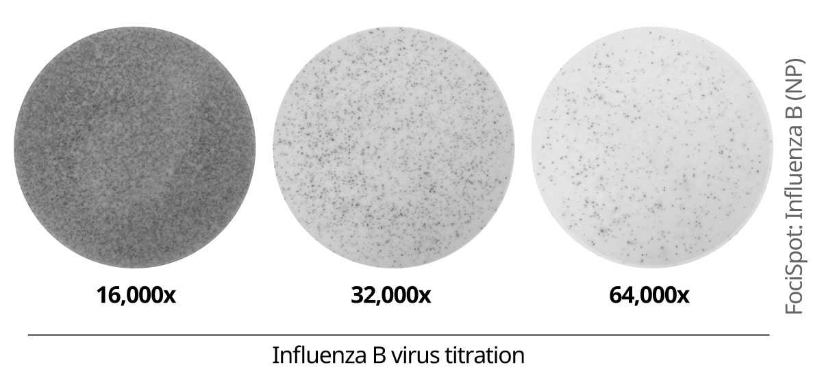 Anti-Influenza B Virus Nucleoprotein Antibody [4D5]