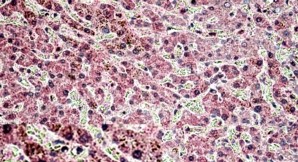 Anti-Golgin-245 Antibody