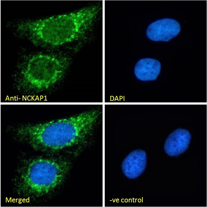 Anti-NCKAP1 Antibody