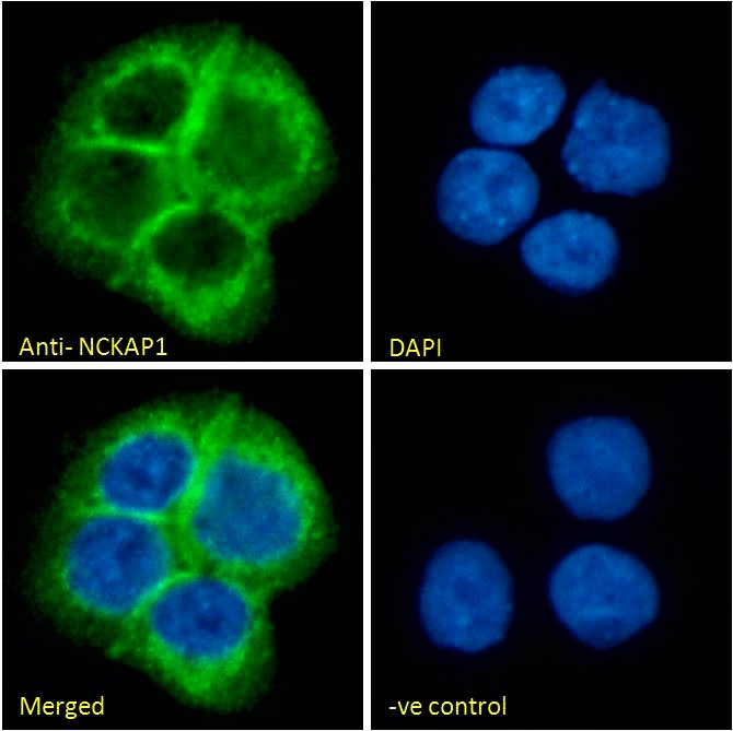 Anti-NCKAP1 Antibody Anti-NCKAP1 Antibody