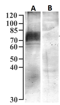Anti-SGLT1 Antibody