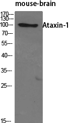 Anti-Ataxin-1 Antibody