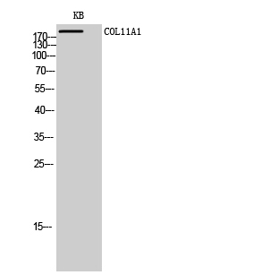 Anti-COL11A1 Antibody