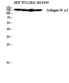 Anti-COL4A2 Antibody Anti-COL4A2 Antibody