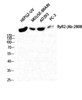 Anti-RyR-2 Antibody