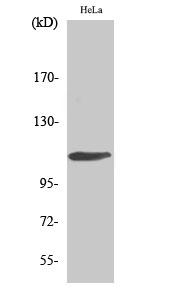 Anti-Rb Antibody