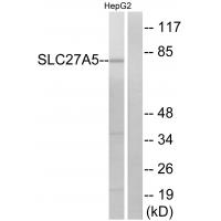 Anti-SLC27A5 Antibody