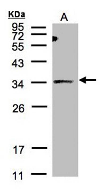 Anti-ST3GAL1 Antibody