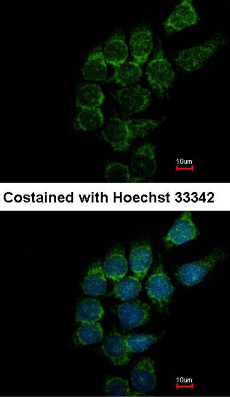 Anti-ST3GAL1 Antibody Anti-ST3GAL1 Antibody