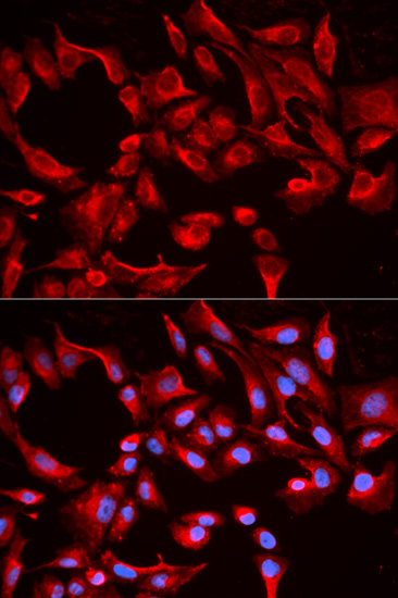 Anti-BCL2L13 Antibody Anti-BCL2L13 Antibody