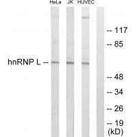 Anti-hnRNP L Antibody