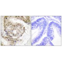 Anti-hnRNP L Antibody Anti-hnRNP L Antibody