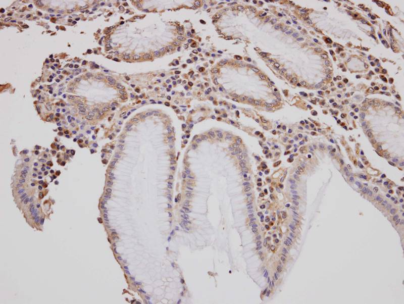 Anti-GOLGA3 Antibody Anti-GOLGA3 Antibody