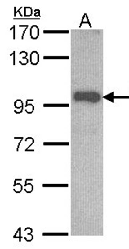 Anti-OSBPL6 Antibody