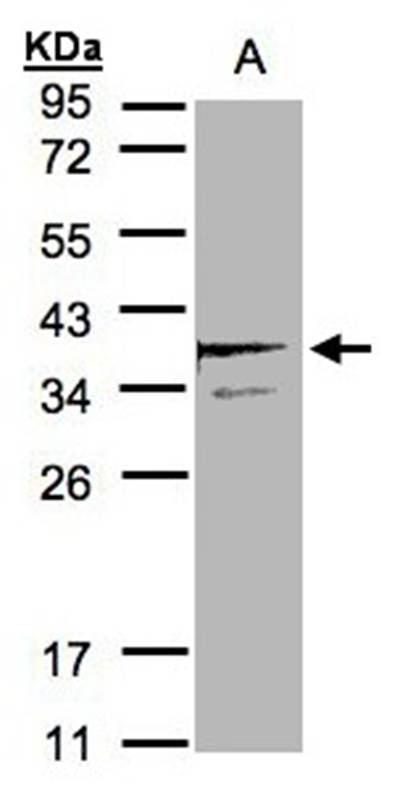 Anti-SCAMP3 Antibody