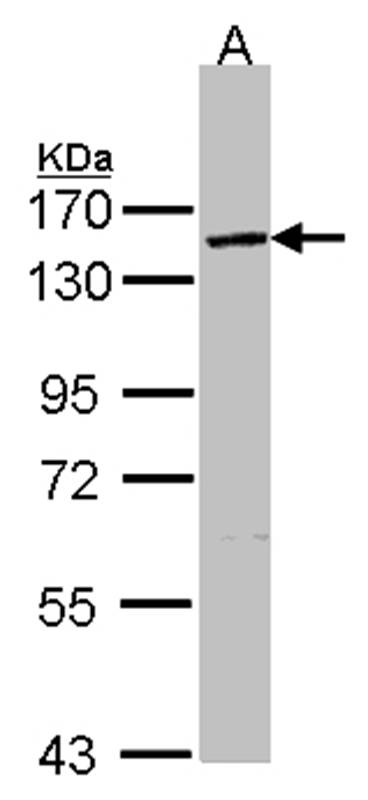 Anti-VCPIP1 Antibody