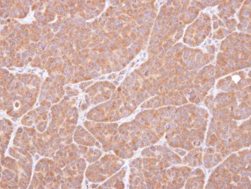 Anti-VCPIP1 Antibody Anti-VCPIP1 Antibody