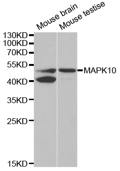 Anti-MAPK10 Antibody