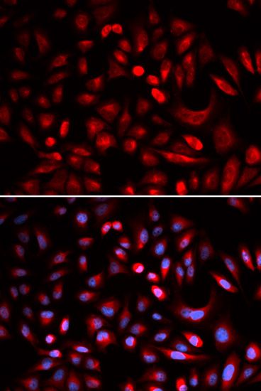 Anti-PRKACB Antibody Anti-PRKACB Antibody