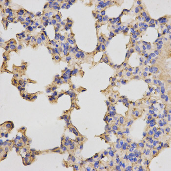 Anti-PRKACB Antibody Anti-PRKACB Antibody