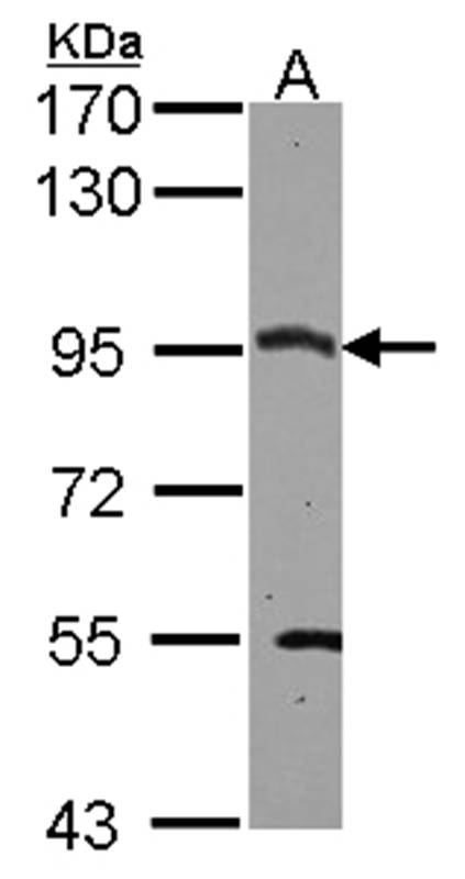 Anti-CSDE1 Antibody