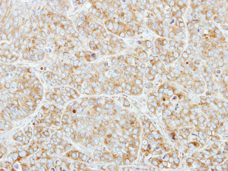 Anti-CSDE1 Antibody Anti-CSDE1 Antibody