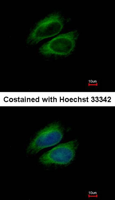Anti-CSDE1 Antibody Anti-CSDE1 Antibody