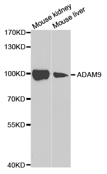 Anti-ADAM9 Antibody