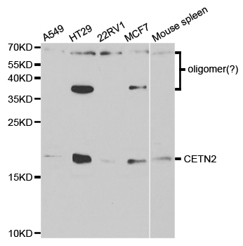 Anti-CETN2 Antibody