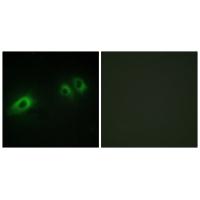 Anti-LAMB1 Antibody Anti-LAMB1 Antibody